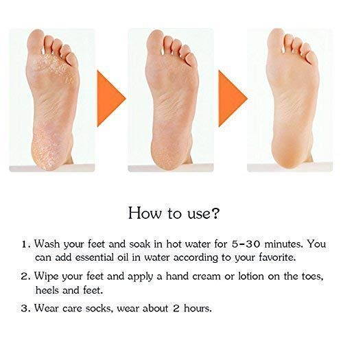 Anti Crack silicone Foot Protector Moisturizing Socks